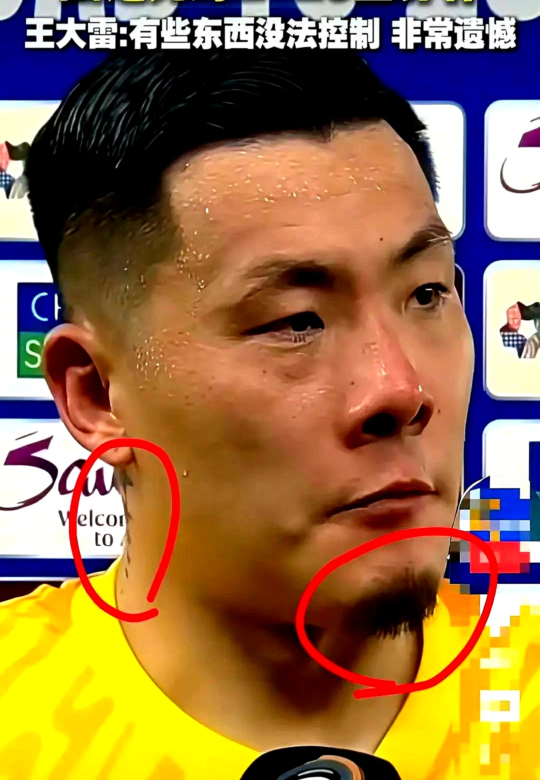 包含首发三将伤愈归队，球队战斗力瞬间提升的词条